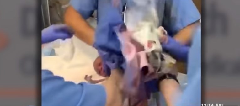 Tata snimio šokantan trenutak u kojem je novorođenče ispalo liječniku iz ruku